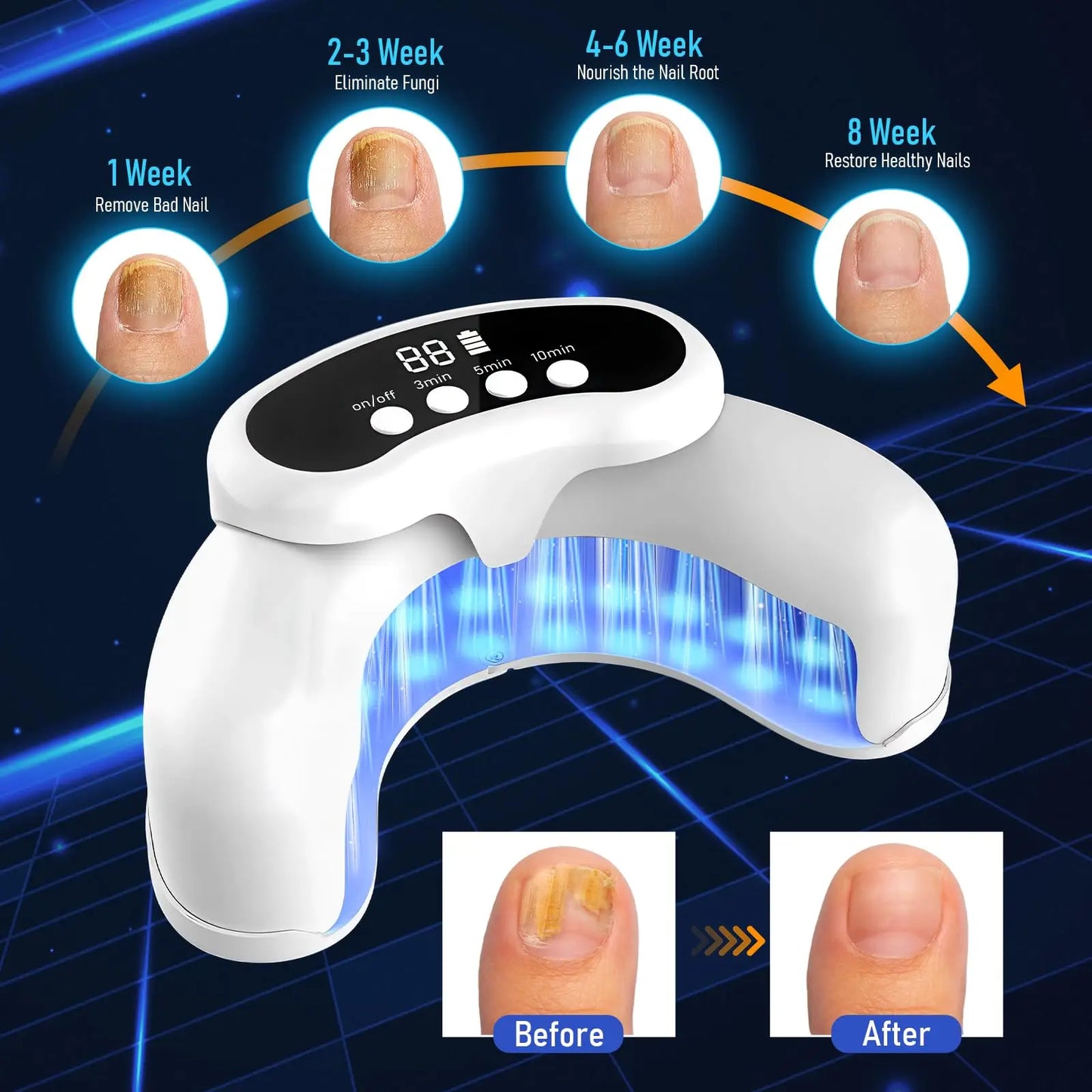 KTS 45W Nail Fungus Treatment With 30 LEDs 470nm 905nm